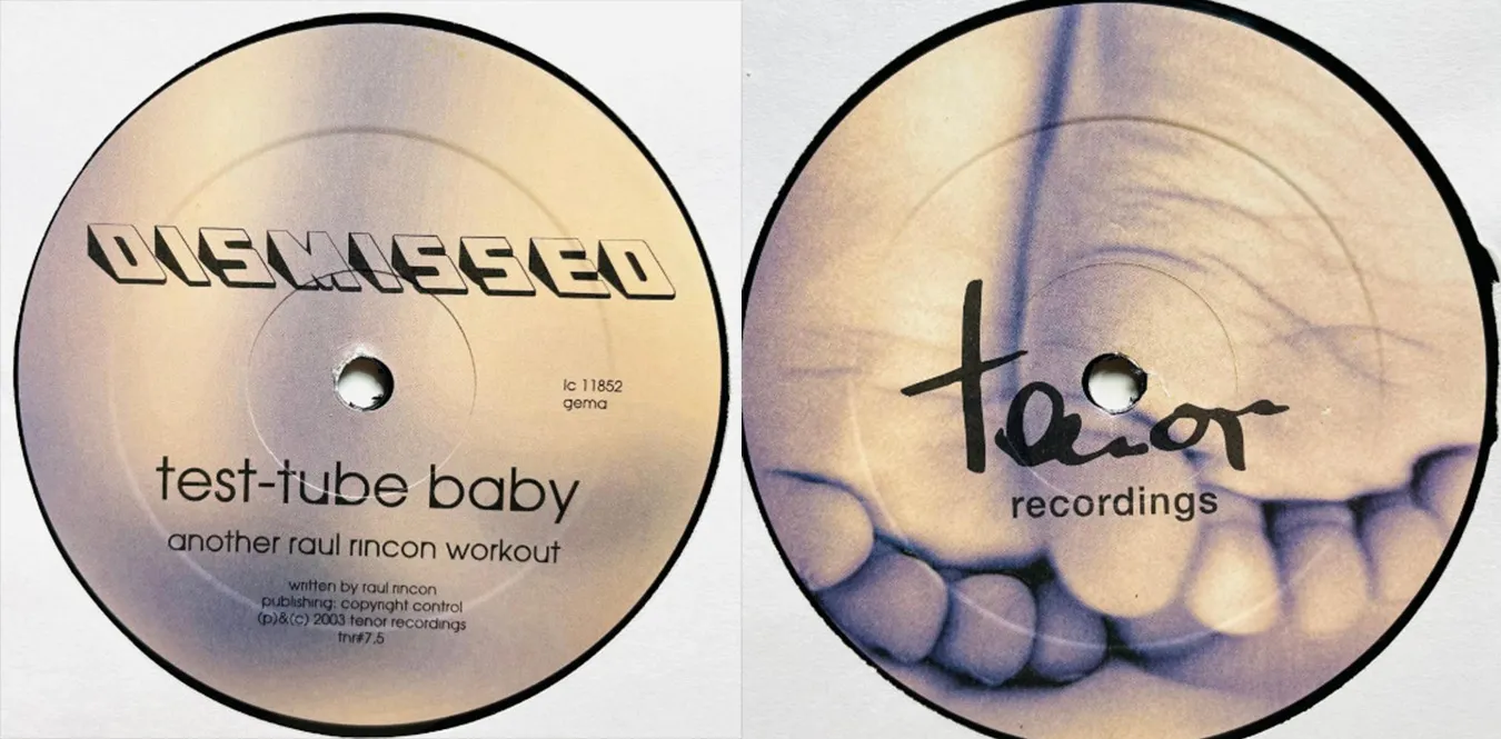 Entlassen – Reagenzglasbaby